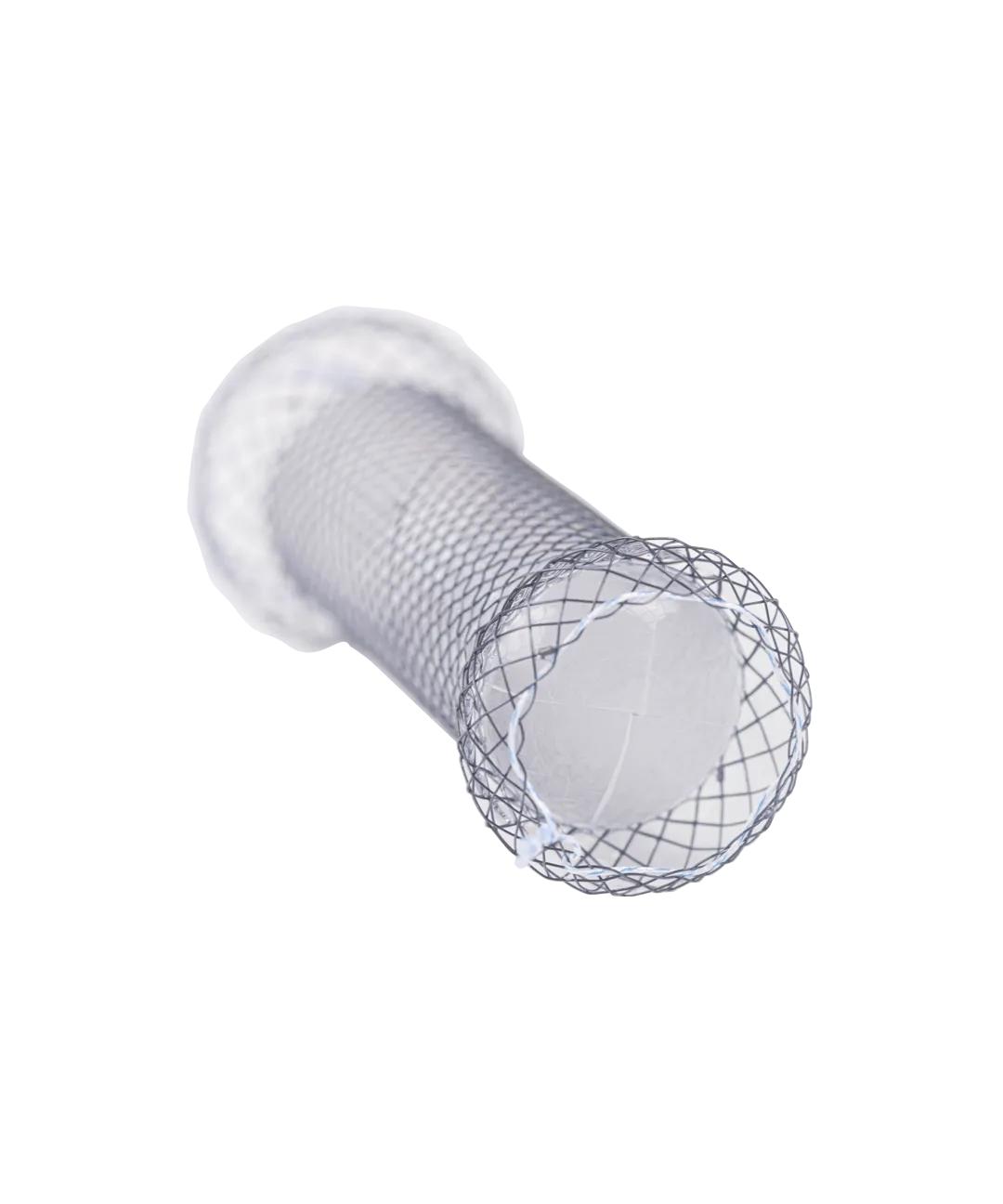 Anti-Reflux Esophageal Stents