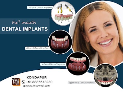 Dental implant 