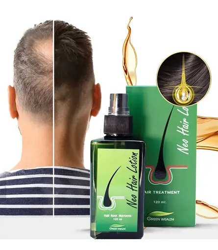 Green Wealth Neo Hair Lotion 120ml In Karachi