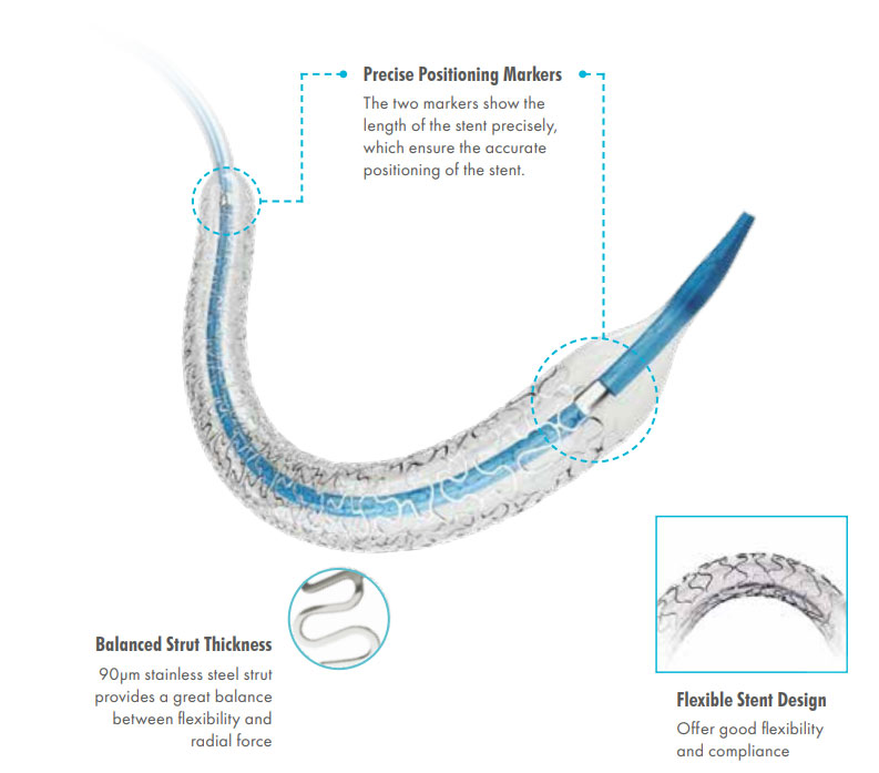 Partner®Sirolimus-eluting Coronary Stent System