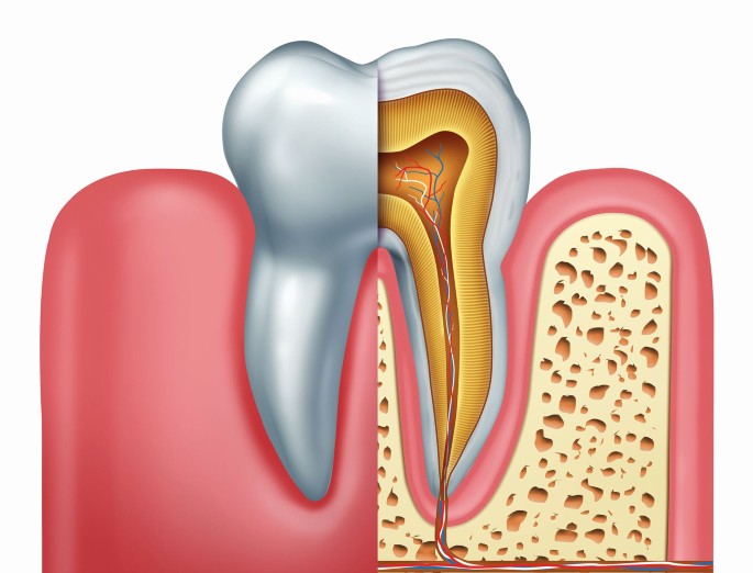 Dental liðskipti