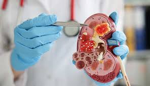 Nephrology (Kidney)