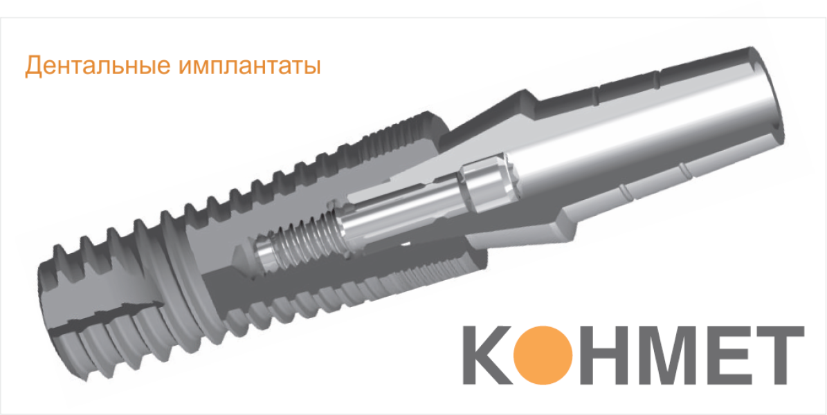 Implantes dentários