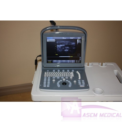 Chison ECO1Vet Veterinary Portable Ultrasound Machine