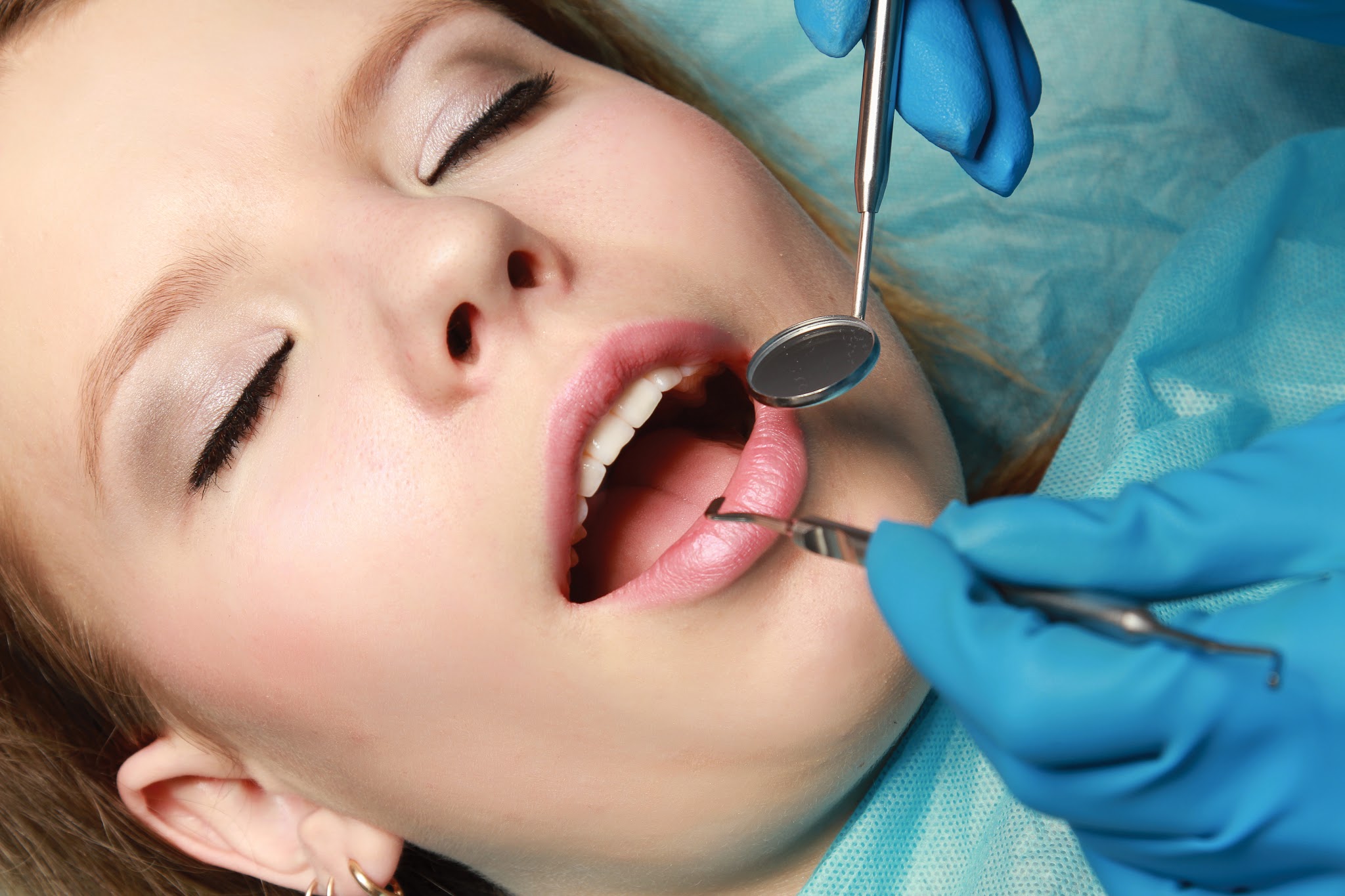 sedation dentistry toronto