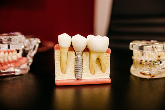 Odontología: suministros