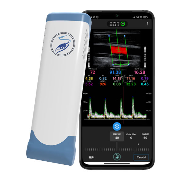 Common Types Of Ultrasonic Probes