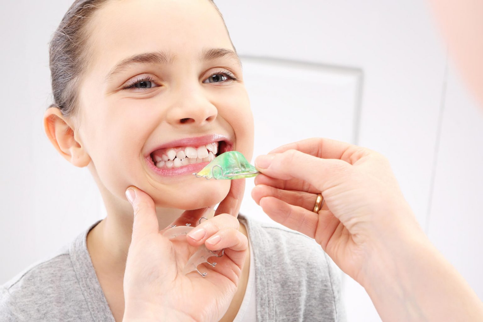 Orthodontische tandbeugels